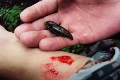 螞蟥咬人怎么辦？螞蟥怎么能殺死？